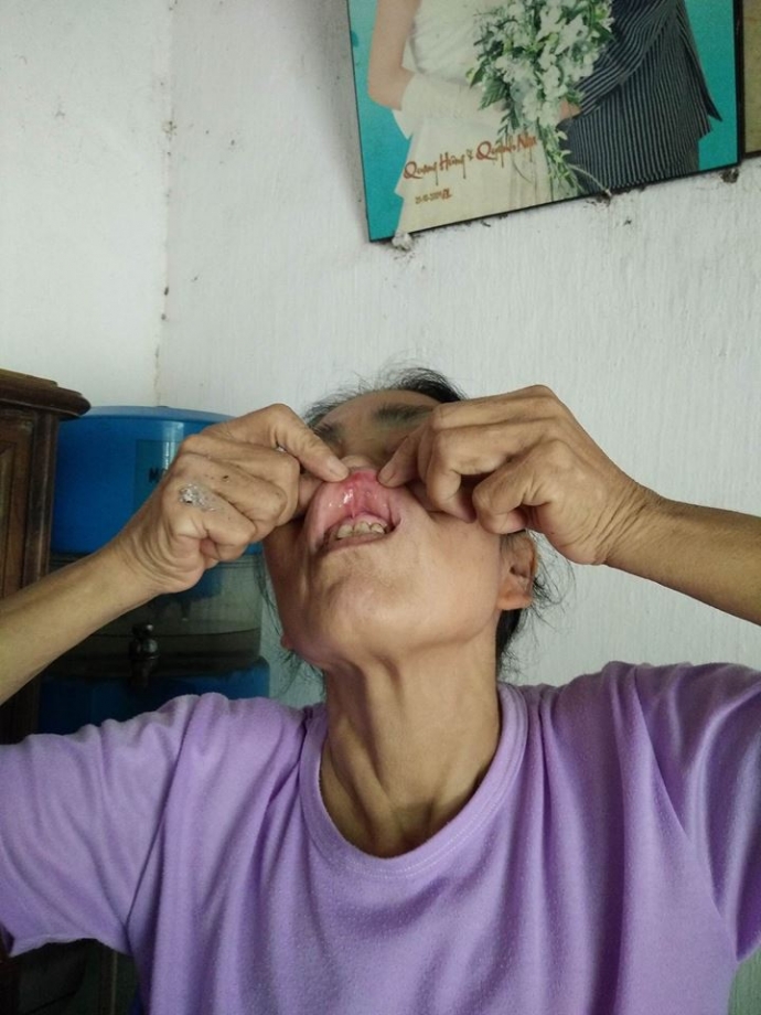 đạn-sượt-qua-môi-hàng-xóm