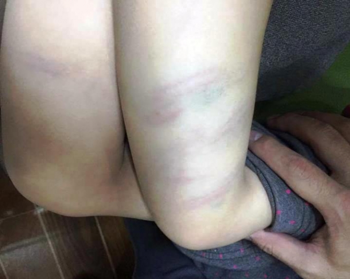 cố -gi&aacute;-o mầm- non- thử -việc- đ&aacute;n-h trẻ- th&acirc;m -t&iacute;