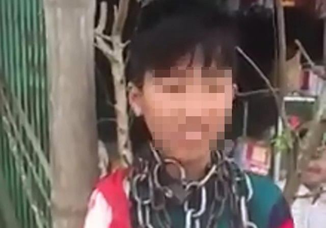 214053-quan-xich-quanh-co-2-1519824579029178014436