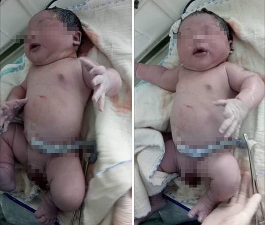 b&eacute; trai hơn 7kg