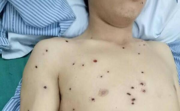 dang-di-duong-bi-na-dan-hoa-cai-khap-co-the_191628