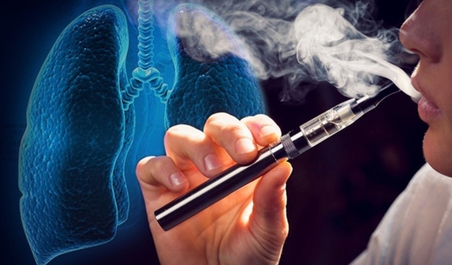 Bộ C&ocirc;ng thương n&oacute;i g&igrave; về đề xuất th&iacute; điểm thuốc l&aacute; điện tử?- Ảnh 1.