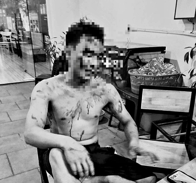 Hải Dương: Nam thanh ni&ecirc;n bị đ&aacute;nh nhập viện khi đang ngồi trong ph&ograve;ng tr&agrave; 
- Ảnh 1.