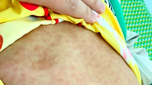 Quảng Nam: L&agrave;m r&otilde; nguy&ecirc;n nh&acirc;n 3 trẻ em ở một x&atilde; miền n&uacute;i tử vong- Ảnh 1.