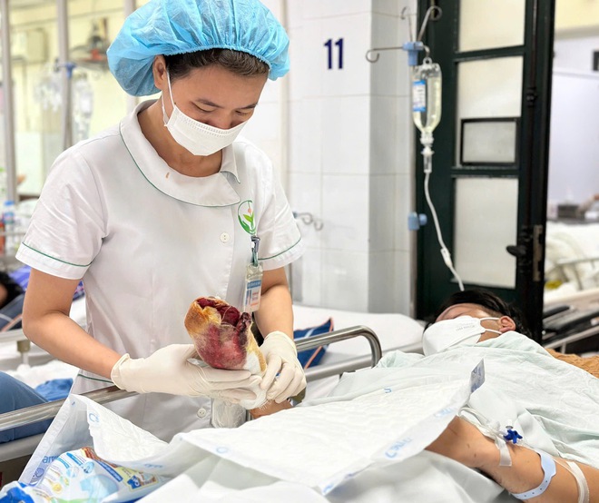 Cận Tết, nhiều ca TNGT, tai nạn ph&aacute;o nổ nhập viện- Ảnh 5.