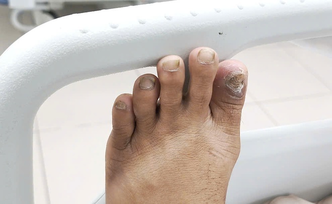 Li&ecirc;n tiếp bệnh nh&acirc;n nguy kịch v&igrave; uốn v&aacute;n- Ảnh 2.