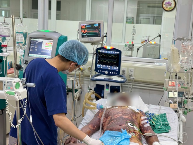 Nhiều ca sốc nhiễm khuẩn, suy đa tạng do nhiễm liên cầu lợn- Ảnh 2.