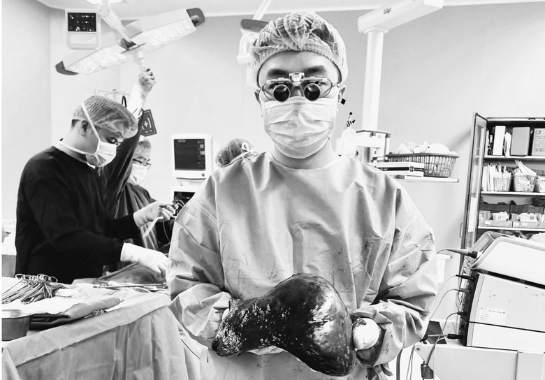 Cắt thành công khối u máu gan "khủng" chiếm gần hết khoang bụng - Ảnh 1. Cắt thành công khối u máu gan "khủng" chiếm gần hết khoang bụng - Ảnh 1.