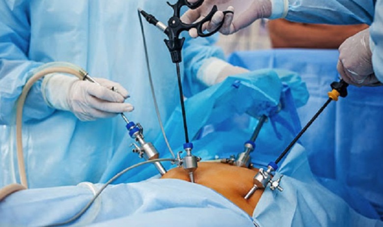 V&igrave; sao cần can thiệp sớm cho d&ugrave; sỏi t&uacute;i mật chưa c&oacute; triệu chứng? - Ảnh 1.