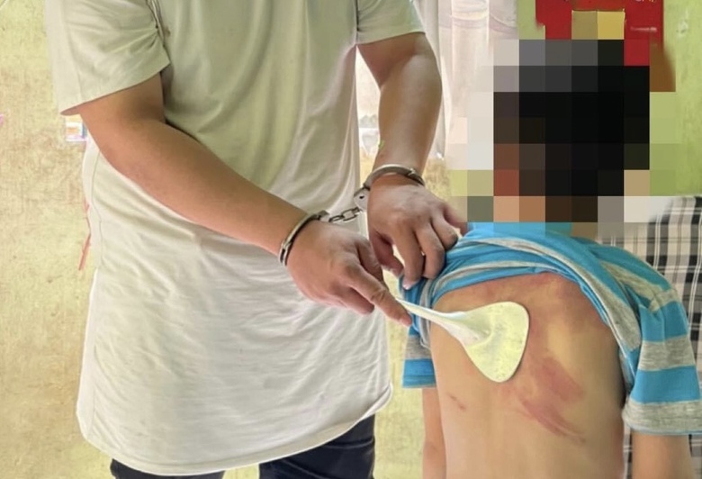 Bắt giữ người đàn ông hành hạ con đẻ - Ảnh 1. Bắt giữ người đàn ông hành hạ con đẻ - Ảnh 1.