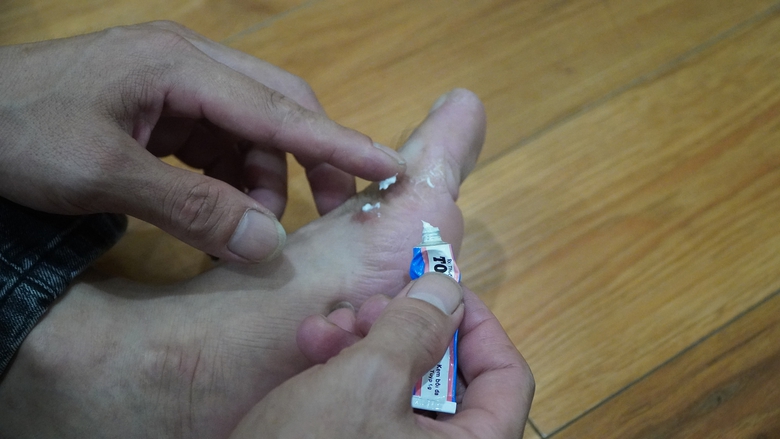 Cư d&acirc;n KĐT Thanh H&agrave; ngứa ng&aacute;y, vi&ecirc;m phụ khoa nghi do nguồn nước, b&aacute;c sĩ n&oacute;i g&igrave;?   - Ảnh 1.