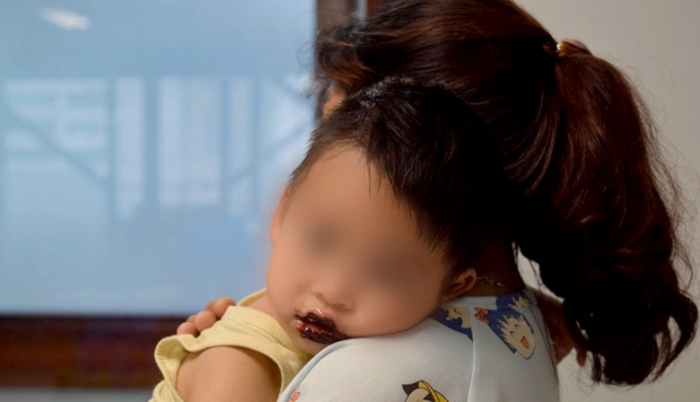 Trẻ uống nhầm h&oacute;a chất, phải l&agrave;m g&igrave;? - Ảnh 1.