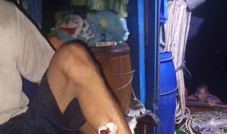 Nh&oacute;m người lạ tấn c&ocirc;ng ngư d&acirc;n Ki&ecirc;n Giang bằng bom xăng, đạn ch&igrave; - Ảnh 2.