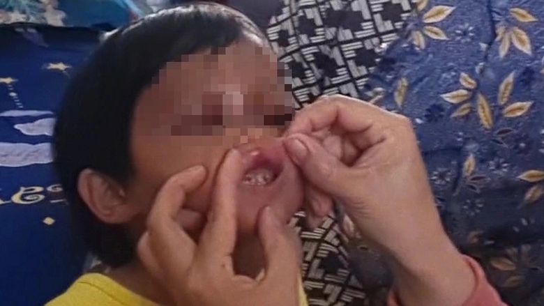 Bắt giam cha nu&ocirc;i bạo h&agrave;nh b&eacute; g&aacute;i 4 tuổi ở C&agrave; Mau - Ảnh 1.