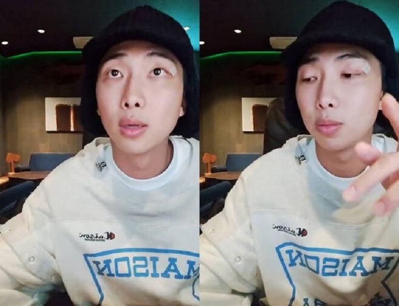 Bị m&aacute;y quay đập v&agrave;o mặt, RM (BTS) kh&acirc;u 5 mũi ở mắt - Ảnh 1.