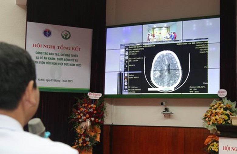 N&acirc;ng cao năng lực bệnh viện tuyến dưới, giảm tải tuyến tr&ecirc;n - Ảnh 1.