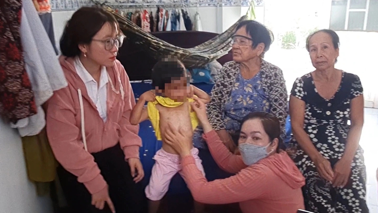 Kịp thời thăm hỏi bé gái 4 tuổi nghi bị cha nuôi đánh đập ở Cà Mau - Ảnh 1. Kịp thời thăm hỏi bé gái 4 tuổi nghi bị cha nuôi đánh đập ở Cà Mau - Ảnh 1.