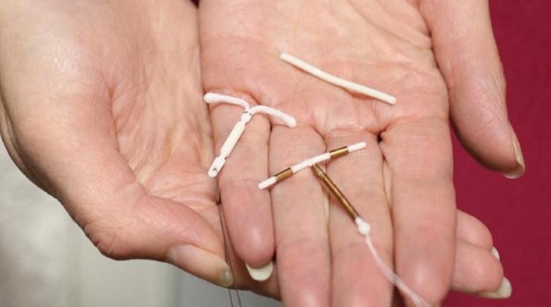 Một phụ nữ 69 tuổi thủng tử cung v&igrave; v&ograve;ng tr&aacute;nh thai đặt c&aacute;ch đ&acirc;y 30 năm   - Ảnh 1.