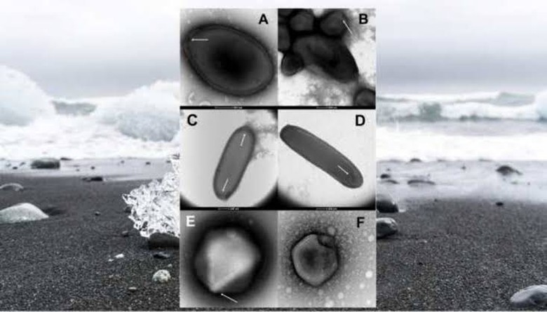 Nguy cơ virus &ldquo;th&acirc;y ma&rdquo; hồi sinh, l&agrave;m b&ugrave;ng đại dịch b&iacute; hiểm- Ảnh 3.