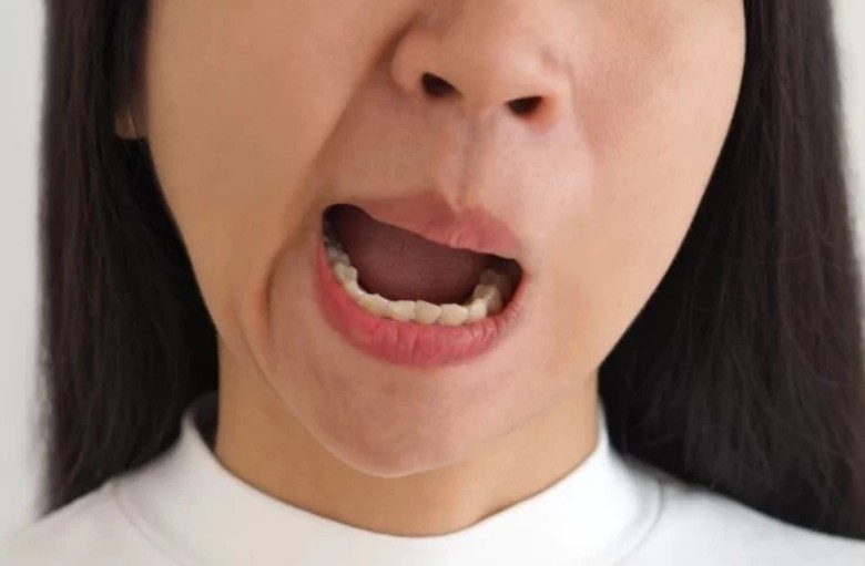 Nhiều người méo miệng, đột quỵ vì giá lạnh- Ảnh 1. Nhiều người méo miệng, đột quỵ vì giá lạnh- Ảnh 1.