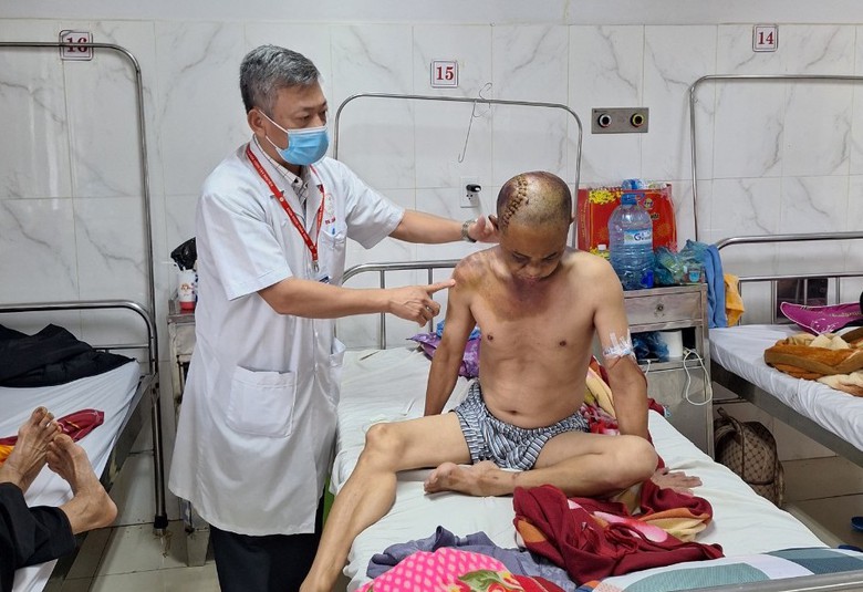 Bắt giữ thanh ni&ecirc;n v&ocirc; cớ đ&aacute;nh người đi đường nhập viện- Ảnh 2.