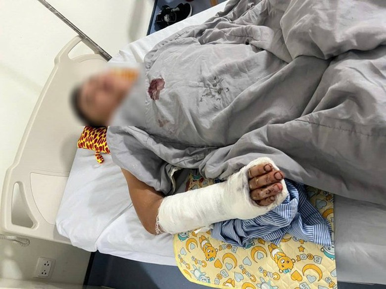 Điều tra vụ 2 người bị ch&eacute;m gục sau c&atilde;i v&atilde; ở qu&aacute;n gội đầu- Ảnh 1.