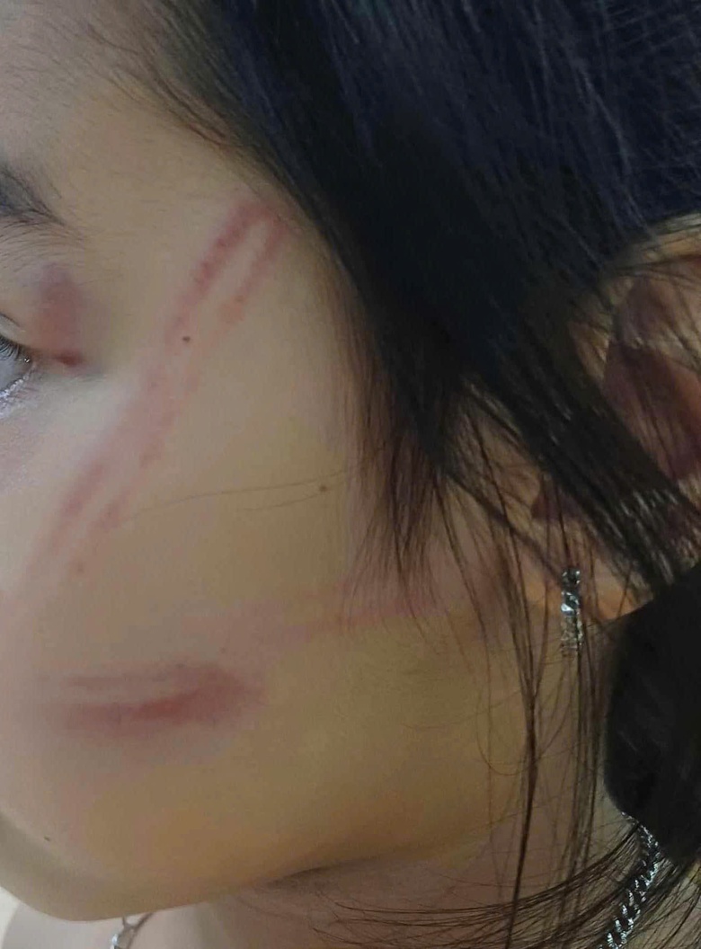 L&agrave;m r&otilde; tr&aacute;ch nhiệm vụ c&aacute;c b&eacute; mầm non bị đ&aacute;nh bầm t&iacute;m khắp người- Ảnh 2.