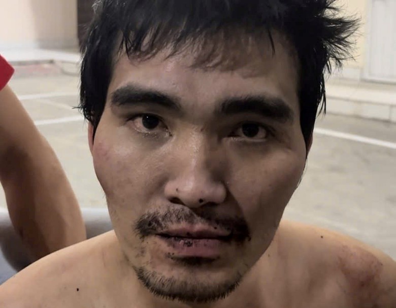 Hải Ph&ograve;ng: Bắt g&atilde; đ&agrave;n &ocirc;ng cầm dao ch&eacute;m 2 người đi đường bị thương  - Ảnh 1.