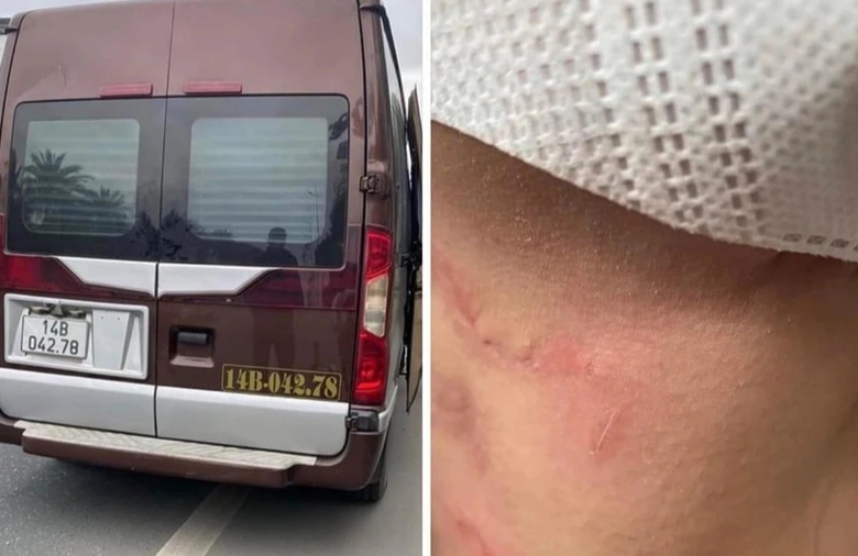 Công an vào cuộc vụ khách tố bị bóp cổ khi đòi xuống xe- Ảnh 1. Công an vào cuộc vụ khách tố bị bóp cổ khi đòi xuống xe- Ảnh 1.