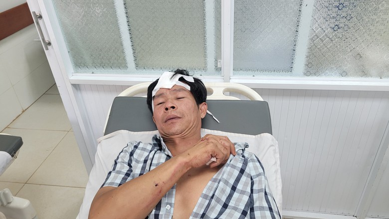 Nạn nh&acirc;n vụ 2 xe kh&aacute;ch t&ocirc;ng nhau ở Gia Lai: Xe kh&aacute;ch chạy nhanh v&agrave; ẩu lắm!- Ảnh 3.