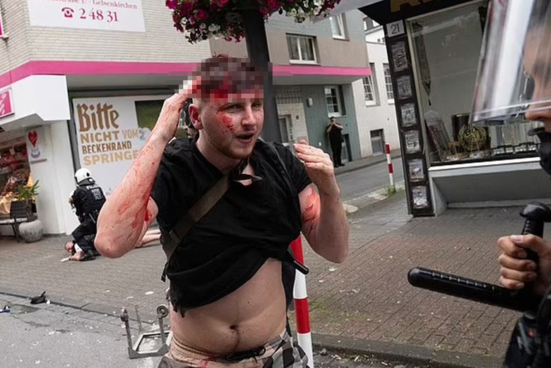 EURO 2024: Bạo loạn kinh ho&agrave;ng, m&aacute;u đ&atilde; đổ trước trận Anh gặp Serbia- Ảnh 2.