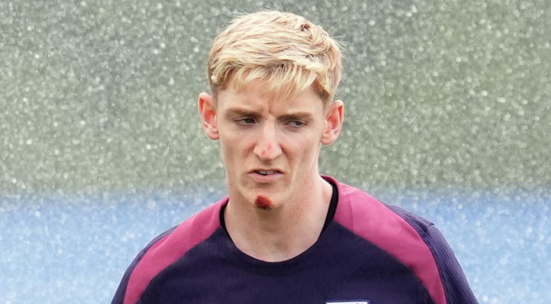 Tin n&oacute;ng EURO ng&agrave;y 28/6: Tiền đạo tuyển Anh d&iacute;nh chấn thương v&igrave; l&yacute; do kh&oacute; đỡ- Ảnh 1.