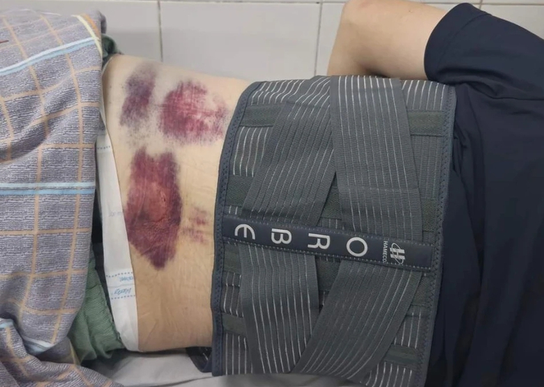 C&ocirc;ng an v&agrave;o cuộc vụ bảo vệ doanh nghiệp đ&aacute;nh người để xe m&aacute;y tr&ecirc;n vỉa h&egrave; ở Quảng Ninh- Ảnh 1.