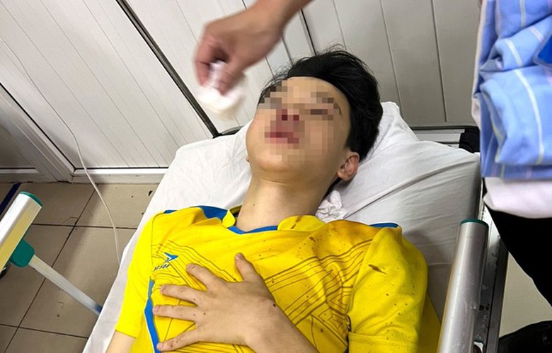 Th&iacute; sinh phải bỏ thi v&igrave; bị tai nạn giao th&ocirc;ng- Ảnh 1.
