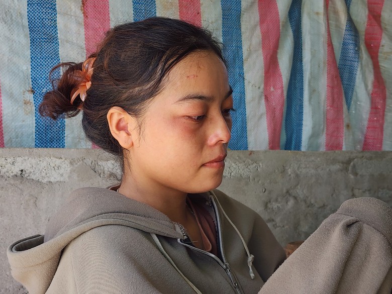 Cha tử vong do tai nạn giao th&ocirc;ng, c&ocirc; g&aacute;i mắc trọng bệnh cầu cứu- Ảnh 2.