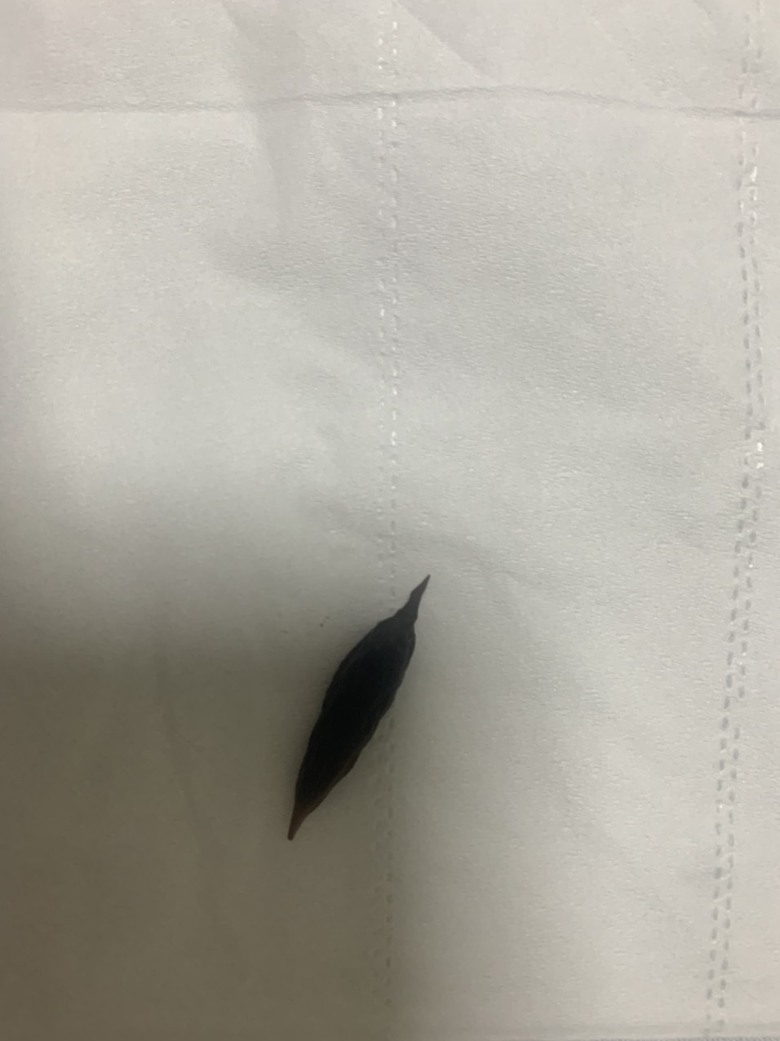 Lỡ nuốt hạt t&aacute;o đỏ khi ăn yến, cụ b&agrave; bị thủng ruột non- Ảnh 2.