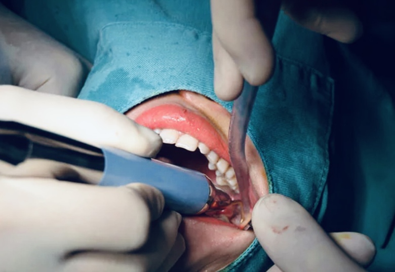 Nam thanh ni&ecirc;n h&ocirc;n m&ecirc; s&acirc;u nghi do sốc phản vệ thuốc t&ecirc; khi nhổ răng- Ảnh 1.