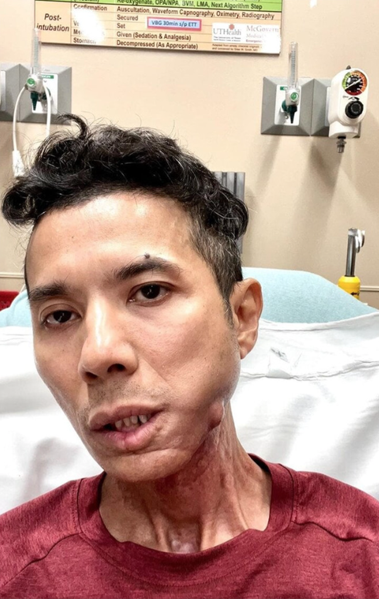 Kasim Ho&agrave;ng Vũ n&oacute;i biết ơn khi kh&ocirc;ng c&ograve;n khả năng ca h&aacute;t- Ảnh 2.