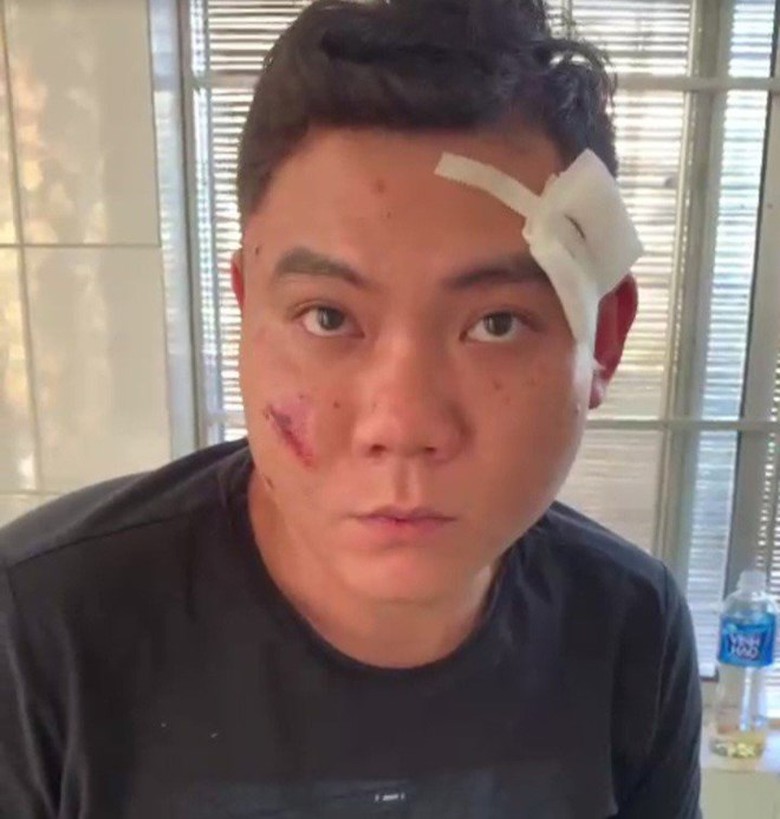 17 năm t&ugrave; cho kẻ d&ugrave;ng s&uacute;ng bắn bị thương bố v&agrave; anh trai người t&igrave;nh cũ- Ảnh 1.