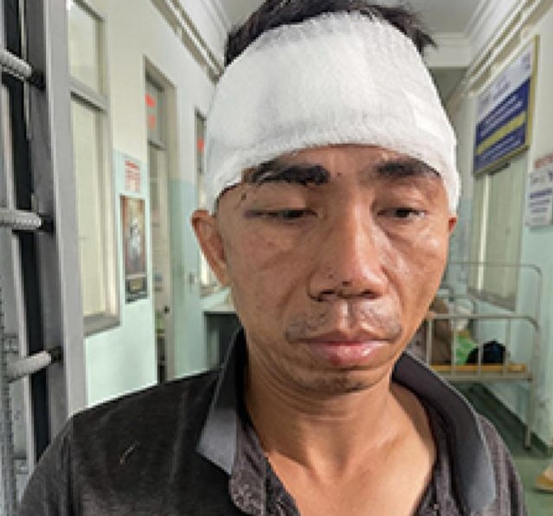 B&igrave;nh Định: C&ocirc;ng an bắt n&oacute;ng đối tượng cướp tiệm v&agrave;ng sau hơn hai giờ g&acirc;y &aacute;n- Ảnh 1.
