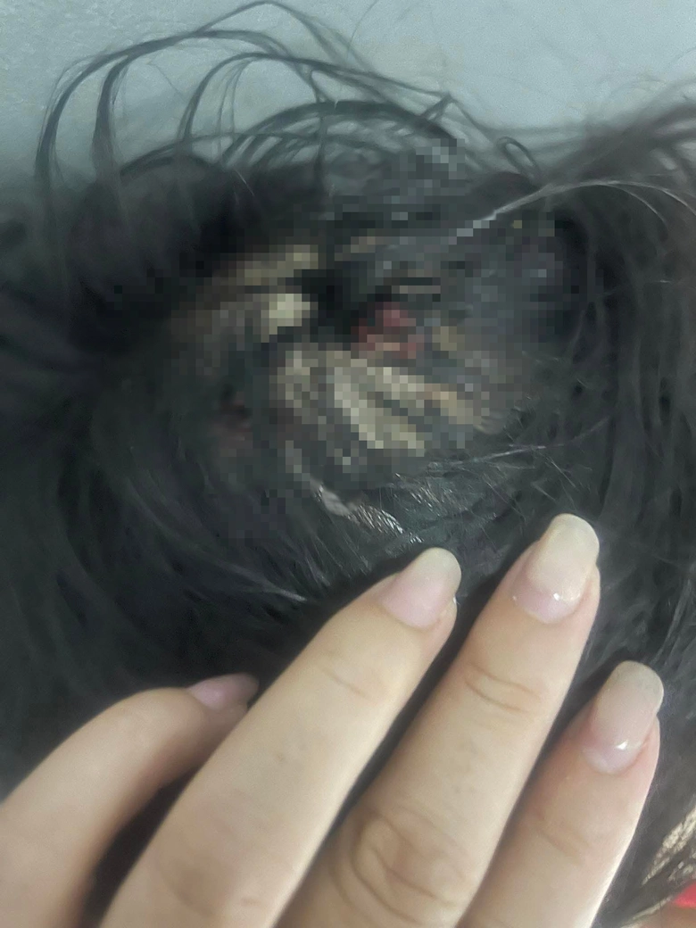 Bắt giữ khẩn cấp người cha dượng bạo hành con riêng ở Hà Tĩnh- Ảnh 2. Bắt giữ khẩn cấp người cha dượng bạo hành con riêng ở Hà Tĩnh- Ảnh 2.