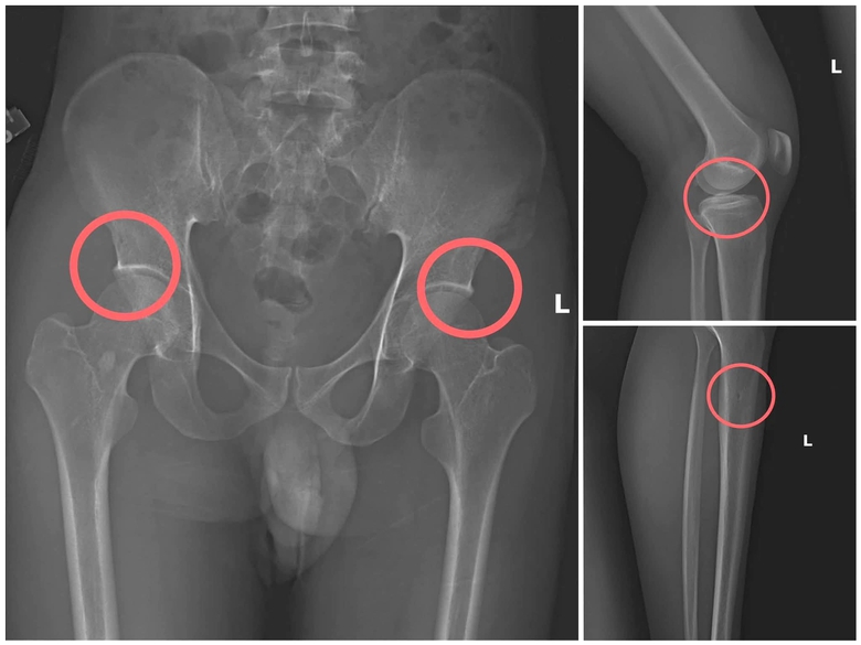C&ocirc;ng an Ph&uacute; Thọ triệt ph&aacute; đường d&acirc;y chiếm đoạt hơn 6 tỷ đồng tiền bảo hiểm nh&acirc;n thọ- Ảnh 4.