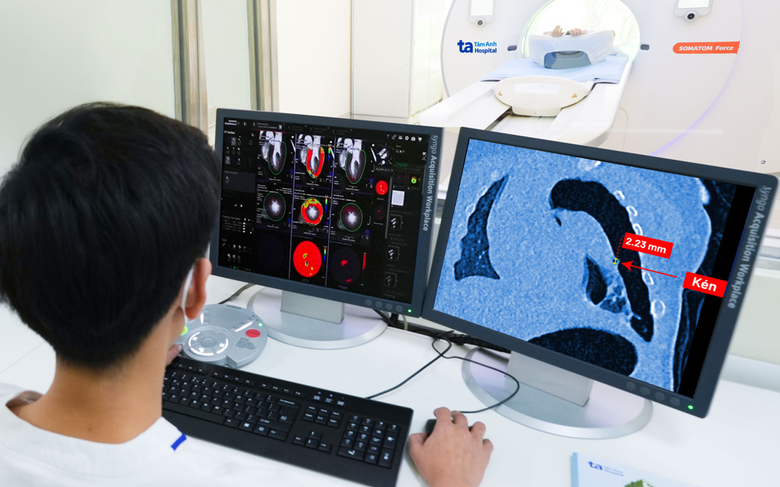 Việt Nam lần đầu ti&ecirc;n sở hữu &ldquo;si&ecirc;u m&aacute;y chụp CT thế hệ mới&rdquo; với số l&aacute;t cắt cực đại- Ảnh 4.