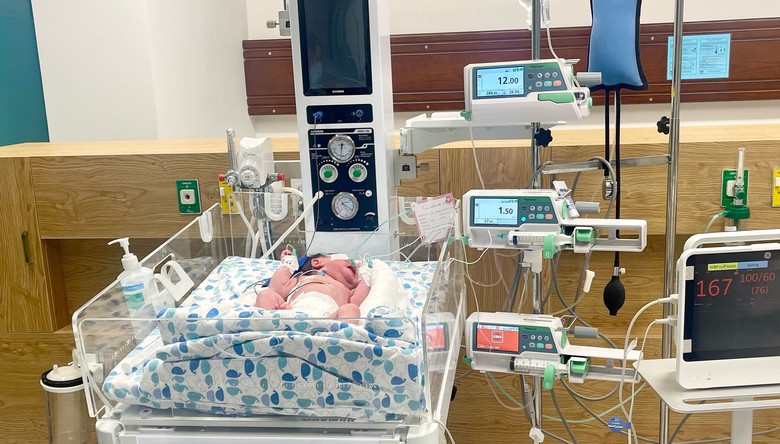 Cứu sống trẻ sơ sinh 2 ng&agrave;y tuổi mắc teo thực quản nguy kịch- Ảnh 2.