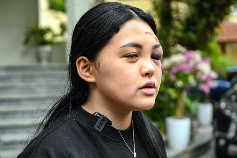 H&agrave; Nội: X&eacute;t xử nữ "qu&aacute;i xế" v&agrave; 23 bị c&aacute;o trong vụ t&ocirc;ng chết c&ocirc; g&aacute;i dừng đ&egrave;n đỏ- Ảnh 2.