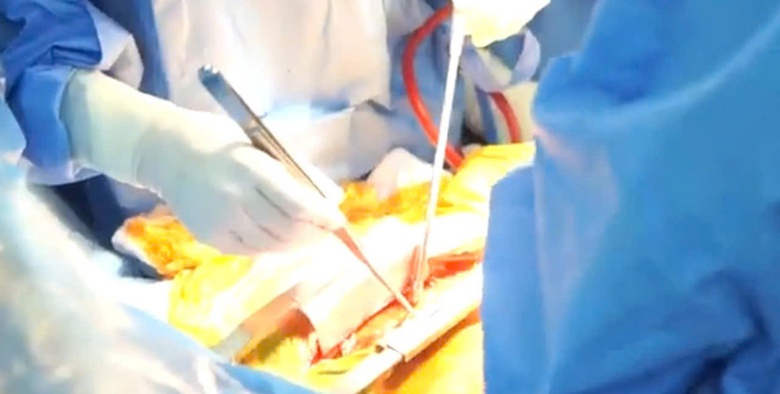 7 bệnh nhân được nhận tạng hiến từ người đàn ông đột quỵ- Ảnh 2. 7 bệnh nhân được nhận tạng hiến từ người đàn ông đột quỵ- Ảnh 2.