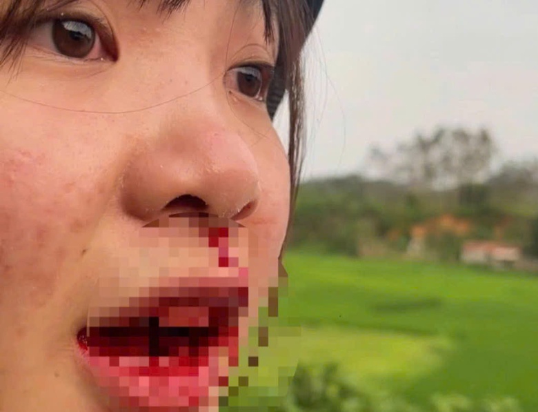 C&ocirc;ng an Bắc Giang v&agrave;o cuộc vụ c&ocirc; g&aacute;i trẻ tố bị t&agrave;i xế &ocirc; t&ocirc; h&agrave;nh hung giữa đường- Ảnh 2.