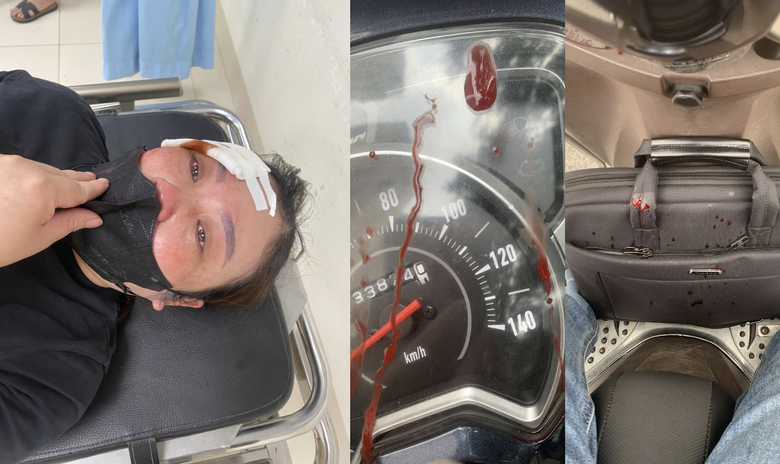 Hà Nội: Xác minh thông tin tài xế xe bán tải vụt dùi cui vào đầu nữ tài xế xe máy- Ảnh 1. Hà Nội: Xác minh thông tin tài xế xe bán tải vụt dùi cui vào đầu nữ tài xế xe máy- Ảnh 1.