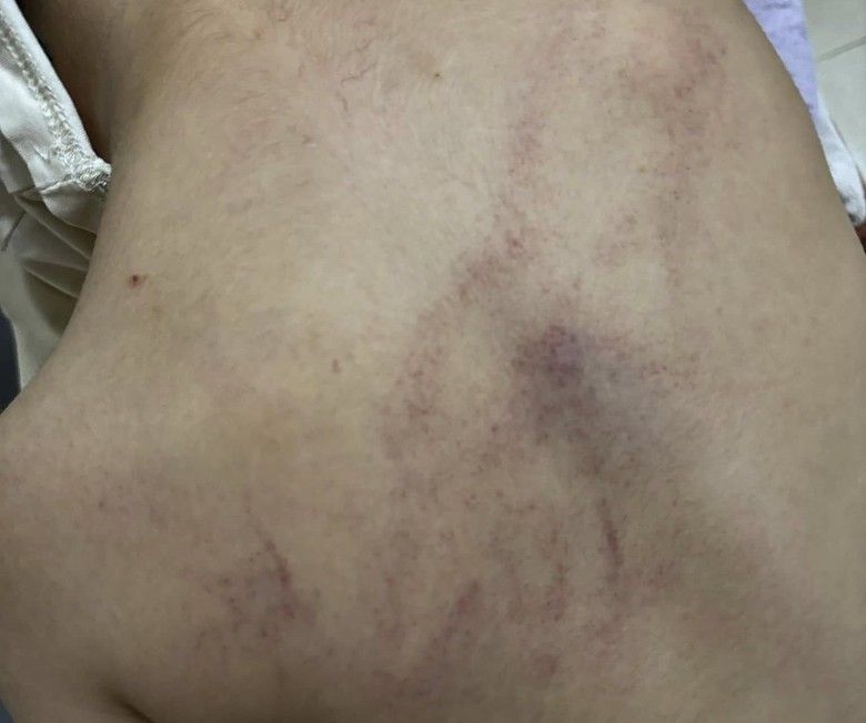 Tạm đình chỉ công tác 2 giáo viên nghi bạo hành trẻ ở trường Mầm non Gia Thụy- Ảnh 1. Tạm đình chỉ công tác 2 giáo viên nghi bạo hành trẻ ở trường Mầm non Gia Thụy- Ảnh 1.