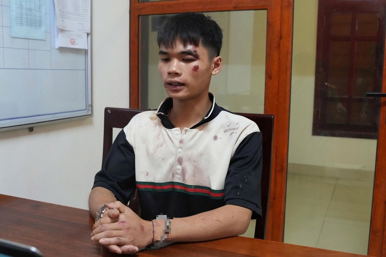 Nghệ An: Ph&aacute; đường d&acirc;y ma t&uacute;y xuy&ecirc;n quốc gia, thu 60 b&aacute;nh heroin v&agrave; 37kg ma t&uacute;y đ&aacute;- Ảnh 3.